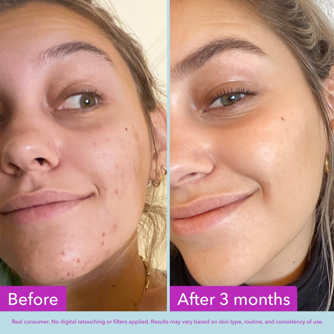 niacinamide-brightening-toner-w8 zb_p.jpg