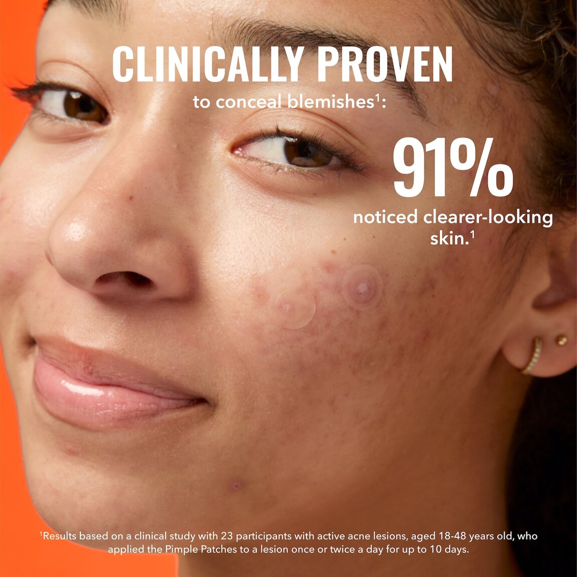 pimple-patches-r5 zb_p.jpg