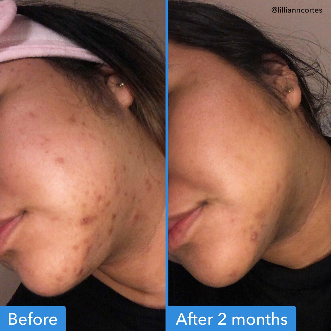 discoloration-correcting-serum-g5 zb_p.jpg